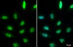 53BP1 Antibody in Immunocytochemistry (ICC/IF)