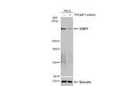 53BP1 Antibody in Western Blot (WB)