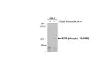 Phospho-ATR (Thr1989) Antibody in Western Blot (WB)