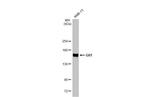 Gli1 Antibody in Western Blot (WB)