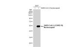 SARS-CoV-2 Nucleocapsid Antibody in Western Blot (WB)