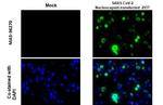 SARS-CoV-2 Nucleocapsid Antibody in Immunocytochemistry (ICC/IF)