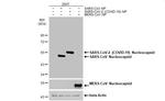 SARS-CoV-2 Nucleocapsid Antibody in Western Blot (WB)