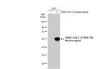 SARS-CoV-2 Nucleocapsid Antibody in Western Blot (WB)