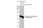 SARS-CoV-2 Nucleocapsid Antibody in Western Blot (WB)