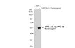 SARS-CoV-2 Nucleocapsid Antibody in Western Blot (WB)