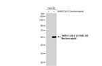 SARS-CoV-2 Nucleocapsid Antibody in Western Blot (WB)