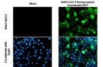 SARS-CoV-2 Nucleocapsid Antibody in Immunocytochemistry (ICC/IF)