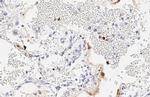 SARS-CoV-2 Nucleocapsid Antibody in Immunohistochemistry (Paraffin) (IHC (P))