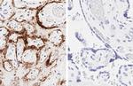 SARS-CoV-2 Nucleocapsid Antibody in Immunohistochemistry (Paraffin) (IHC (P))
