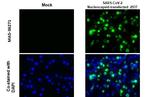 SARS-CoV-2 Nucleocapsid Antibody in Immunocytochemistry (ICC/IF)