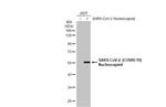 SARS-CoV-2 Nucleocapsid Antibody in Western Blot (WB)