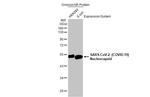 SARS-CoV-2 Nucleocapsid Antibody in Western Blot (WB)