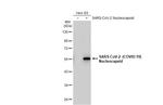 SARS-CoV-2 Nucleocapsid Antibody in Western Blot (WB)