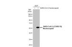 SARS-CoV-2 Nucleocapsid Antibody in Western Blot (WB)