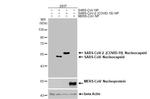 SARS-CoV-2 Nucleocapsid Antibody in Western Blot (WB)