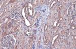 Bax Antibody in Immunohistochemistry (Paraffin) (IHC (P))