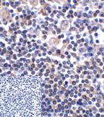 CD276 (B7-H3) Antibody in Immunohistochemistry (Paraffin) (IHC (P))