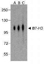 CD276 (B7-H3) Antibody in Western Blot (WB)