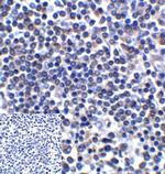 CD276 (B7-H3) Antibody in Immunohistochemistry (Paraffin) (IHC (P))