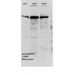 hnRNP F/H Antibody in Western Blot (WB)