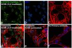 Phospho-Stat6 (Tyr641) Antibody in Immunocytochemistry (ICC/IF)