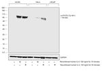 Phospho-Stat6 (Tyr641) Antibody in Western Blot (WB)