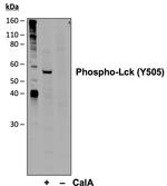 Phospho-Lck (Tyr505) Antibody in Western Blot (WB)