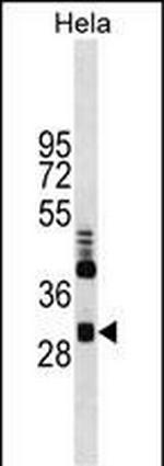 CLIC4 Antibody in Western Blot (WB)