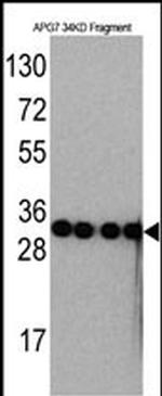 ATG7 Antibody in Western Blot (WB)