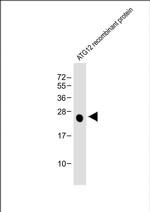 ATG12 Antibody in Western Blot (WB)