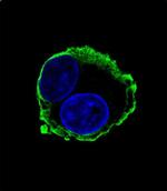 MMP14 Antibody in Immunocytochemistry (ICC/IF)