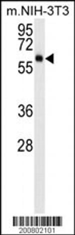 AKT3 Antibody in Western Blot (WB)