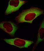 eIF4E Antibody in Immunocytochemistry (ICC/IF)