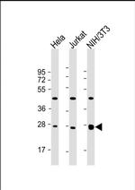 eIF4E Antibody in Western Blot (WB)