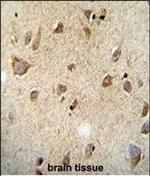 RET Antibody in Immunohistochemistry (Paraffin) (IHC (P))