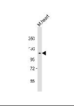 RET Antibody in Western Blot (WB)