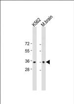 CAB39 Antibody in Western Blot (WB)