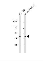 RSK1 Antibody in Western Blot (WB)