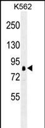 RSK1 Antibody in Western Blot (WB)