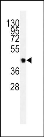 VEGFC Antibody in Western Blot (WB)