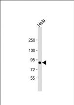 TGM2 Antibody in Western Blot (WB)