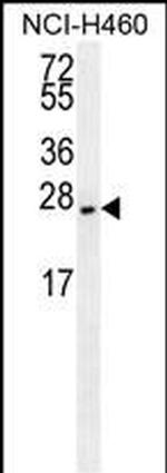 eIF4E2 Antibody in Western Blot (WB)