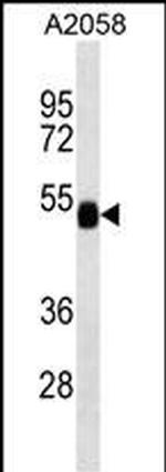 FUCA2 Antibody in Western Blot (WB)