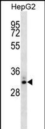 STC2 Antibody in Western Blot (WB)