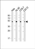 RCC1 Antibody in Western Blot (WB)