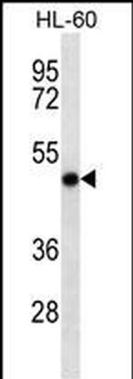 RCC1 Antibody in Western Blot (WB)