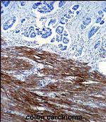 ACTA1 Antibody in Immunohistochemistry (Paraffin) (IHC (P))