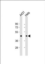 ACTA1 Antibody in Western Blot (WB)