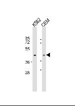 PDK4 Antibody in Western Blot (WB)